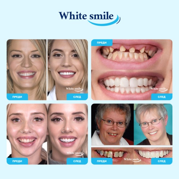 Изкуствени зъби протези WhiteSmile