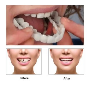 Изкуствени зъби протези WhiteSmile
